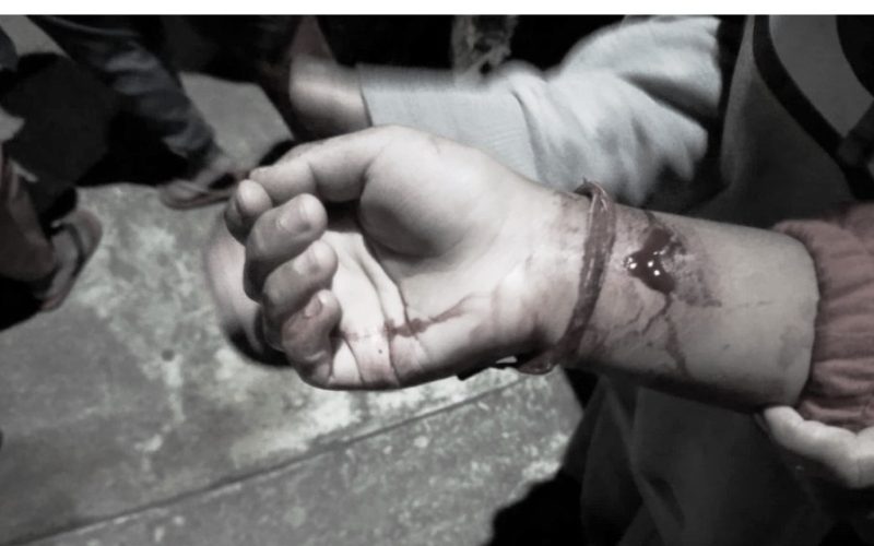 हेटौँडामा आमा र छिमेकीहरुलाई युवाद्वारा छुरा प्रहार